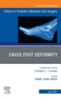Cavus Foot Deformity, An Issue of Clinics in Podiatric Medicine and Surgery, E-Book : Cavus Foot Deformity, An Issue of Clinics in Podiatric Medicine and Surgery, E-Book - eBook