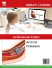 Lecturio Lectures - Cardiovascular System: Arterial Diseases - eBook