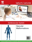Lecturio Lectures - Cardiovascular System: Vascular Malformations - eBook