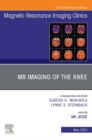 MR Imaging of The Knee, An Issue of Magnetic Resonance Imaging Clinics of North America, E-Book : MR Imaging of The Knee, An Issue of Magnetic Resonance Imaging Clinics of North America, E-Book - eBook