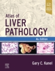 Atlas of Liver Pathology - eBook