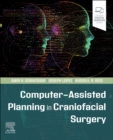 Computer-Assisted Planning in Craniofacial Surgery - Book