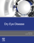 Dry Eye Disease - E-Book - eBook