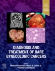 Diagnosis and Treatment of Rare Gynecologic Cancers - Book