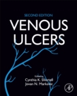 Venous Ulcers - Book