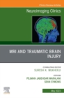 MRI and Traumatic Brain Injury, An Issue of Neuroimaging Clinics of North America, E-Book : MRI and Traumatic Brain Injury, An Issue of Neuroimaging Clinics of North America, E-Book - eBook