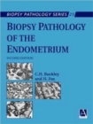 Biopsy Pathology of the Endometrium, 2Ed - Book