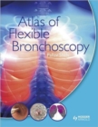 Atlas of Flexible Bronchoscopy - Book