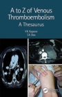 A to Z of Venous Thromboembolism : A Thesaurus - Book