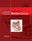 Textbook of Bladder Cancer - Book