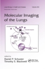 Molecular Imaging of the Lungs - Book