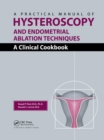 A Practical Manual of Hysteroscopy and Endometrial Ablation Techniques : A Clinical Cookbook - Book