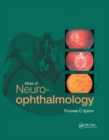 Atlas of Neuro-ophthalmology - Book