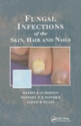 Fungal Infections of the Skin and Nails - Book