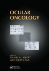 Ocular Oncology - Book