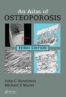 An Atlas of Osteoporosis - Book