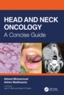Head and Neck Oncology : A Concise Guide - Book