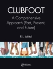 Clubfoot : A Comprehensive Approach (Past, Present, and Future) - Book