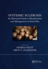 Systemic Sclerosis : An Illustrated Guide to Manifestation and Management in Asian Skin - Book