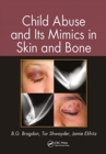 Child Abuse and its Mimics in Skin and Bone - Book