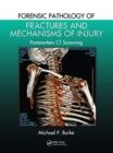 Forensic Pathology of Fractures and Mechanisms of Injury : Postmortem CT Scanning - Book