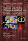 Principles and Practice of Image-Guided Radiation Therapy of Lung Cancer - Book
