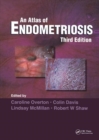 Atlas of Endometriosis - Book
