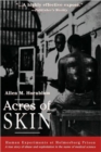 Acres of Skin : Human Experiments at Holmesburg Prison - Book