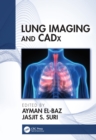 Lung Imaging and CADx - eBook
