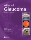 Atlas of Glaucoma - eBook