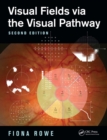 Visual Fields via the Visual Pathway - eBook