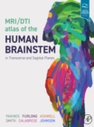 MRI/DTI Atlas of the Human Brainstem in Transverse and Sagittal Planes - eBook