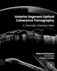 Anterior Segment Optical Coherence Tomography : A Clinically-Oriented Atlas - Book