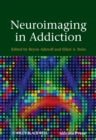 Neuroimaging in Addiction - Book