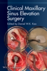 Clinical Maxillary Sinus Elevation Surgery - Book