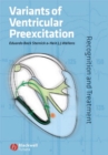 Variants of Ventricular Preexcitation : Recognition and Treatment - eBook