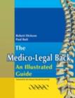 Medico-Legal Back: An Illustrated Guide - eBook