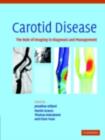 Carotid Disease : The Role of Imaging in Diagnosis and Management - eBook