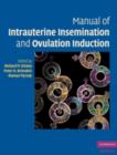 Manual of Intrauterine Insemination and Ovulation Induction - eBook