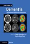 Case Studies in Dementia: Volume 1 : Common and Uncommon Presentations - Book