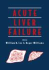 Acute Liver Failure - Book