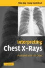 Interpreting Chest X-Rays : Illustrated with 100 Cases - Book