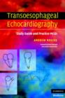 Transoesophageal Echocardiography : Study Guide and Practice MCQs - Book