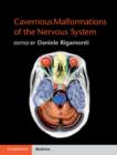 Cavernous Malformations of the Nervous System - Book
