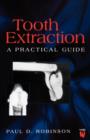Tooth Extraction : A Practical Guide - Book