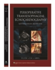 Perioperative Transesophageal Echocardiography Self-Assessment and Review - Book