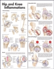 Hip and Knee Inflammations Anatomical Chart - Book