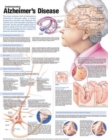 Understanding Alzheimer's Disease Anatomical Chart - Book