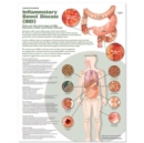 Understanding Inflammatory Bowel Disease (IBD) Anatomical Chart - Book