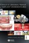Clinical and Laboratory Manual of Implant Overdentures - Book